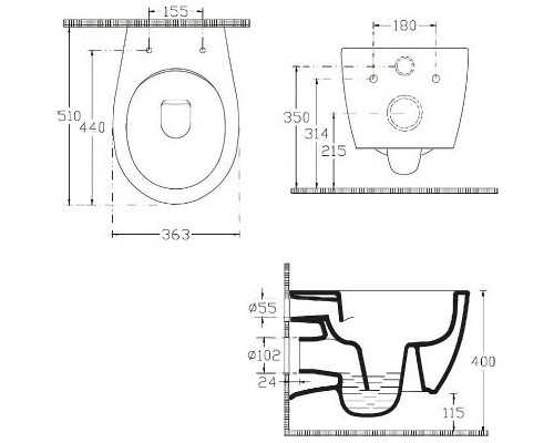 Унитаз биде Allen Brau Fantasy 4.11HC1.20 подвесной Белый без сиденья